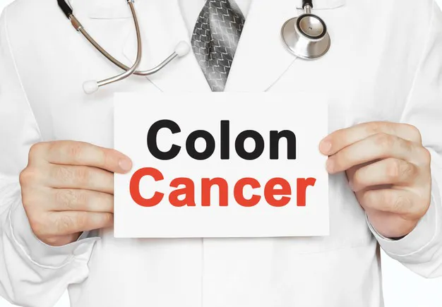 Colon Cancer Treatment - Blog Image