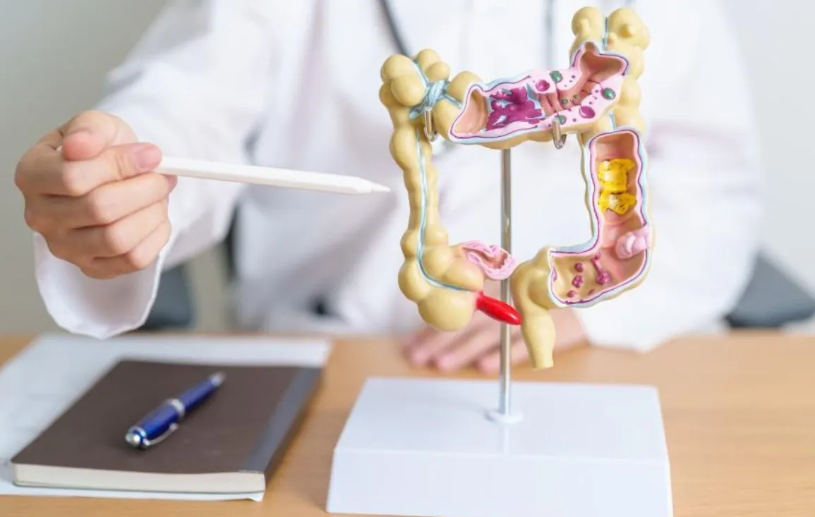 Rectal Prolapse: Causes, Symptoms, and Modern Treatment Options - Blog Image
