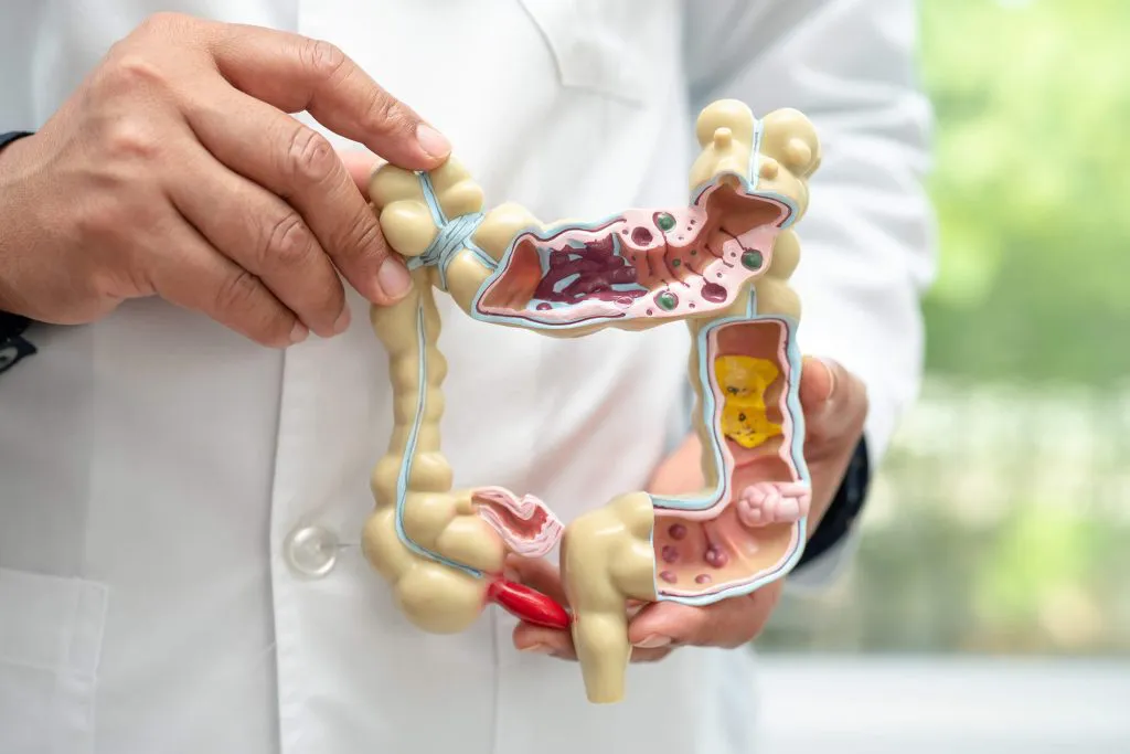 Colon Health: Symptoms of Colon Diseases & When to Seek Help - Blog Image