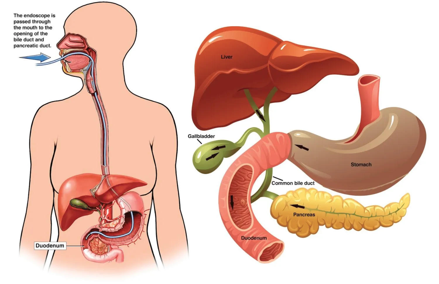 ERCP Procedure Explained: Purpose, Preparation, and Recovery - Blog Image