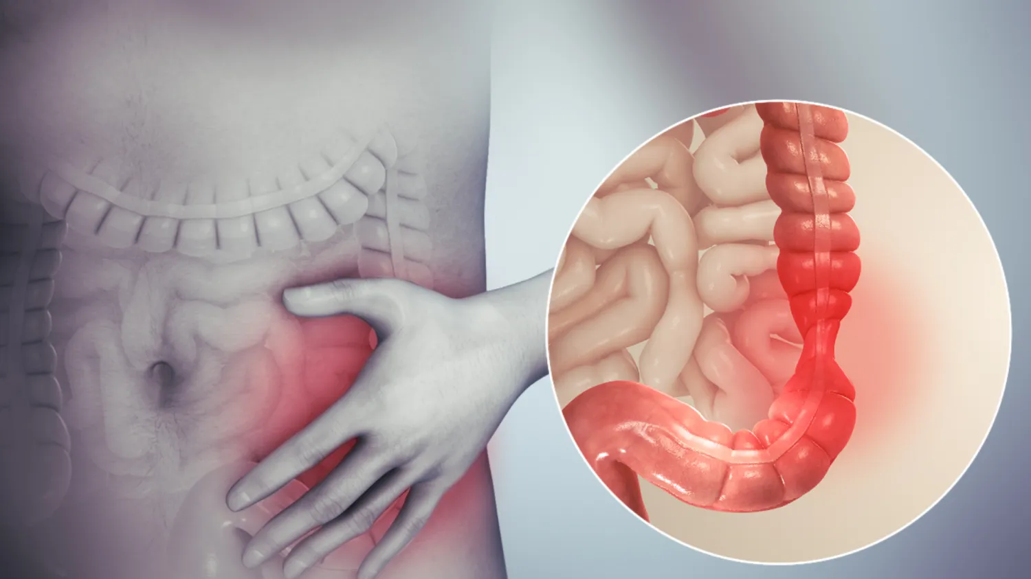 Irritable Bowel Syndrome (IBS): Symptoms and Management Tips - Blog Image