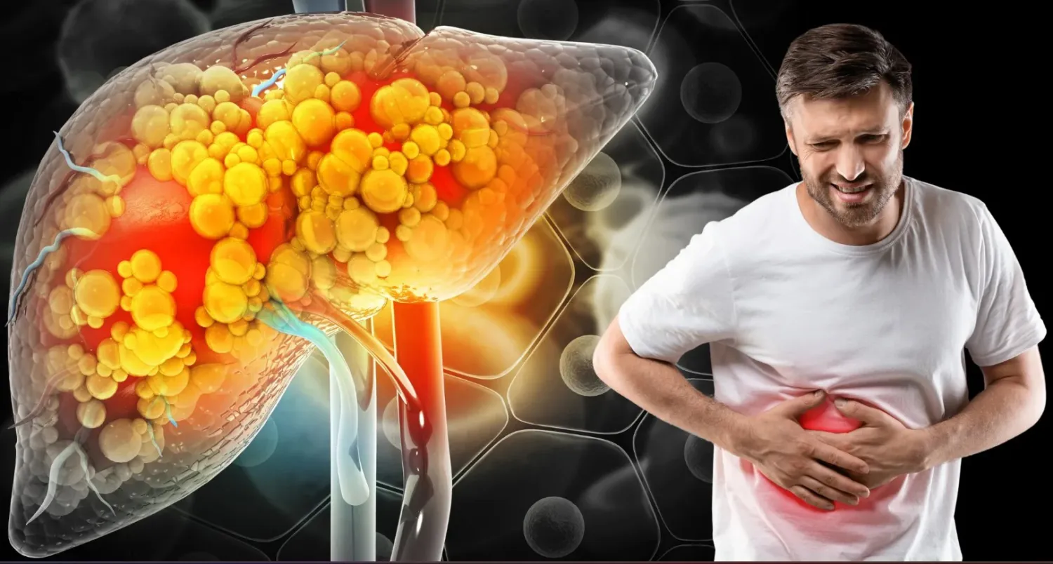 Fatty Liver Treatment: When to Visit the Best Gastroenterologist in Faridabad - Blog Image